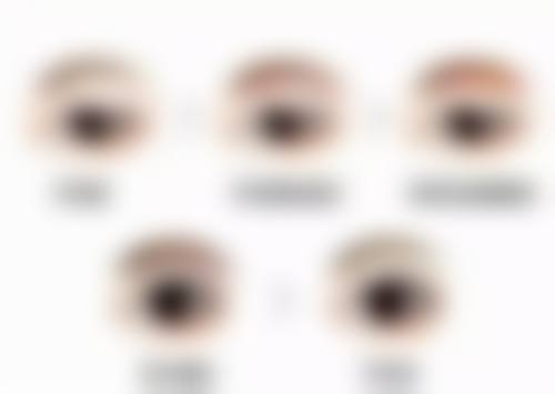 五、疤痕修复的时间与注意事项