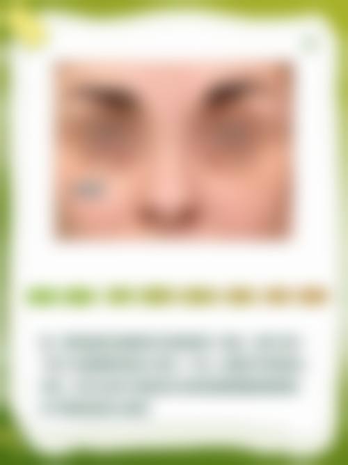 六、成都锦江纽蜜医疗美容价格表