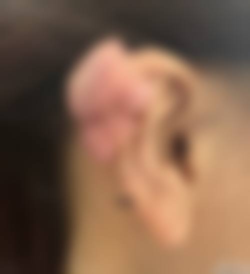 五、龙口锦秀成美医疗美容门诊部价格表