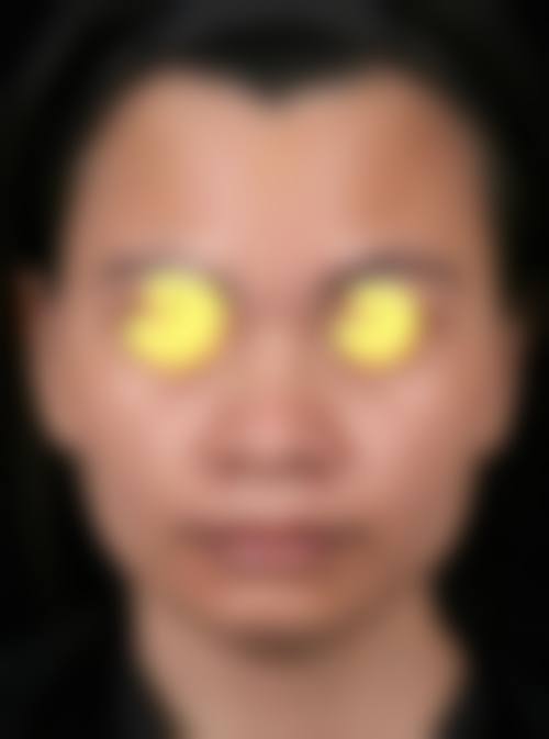 八、成都锦江纽蜜医疗美容预约方式