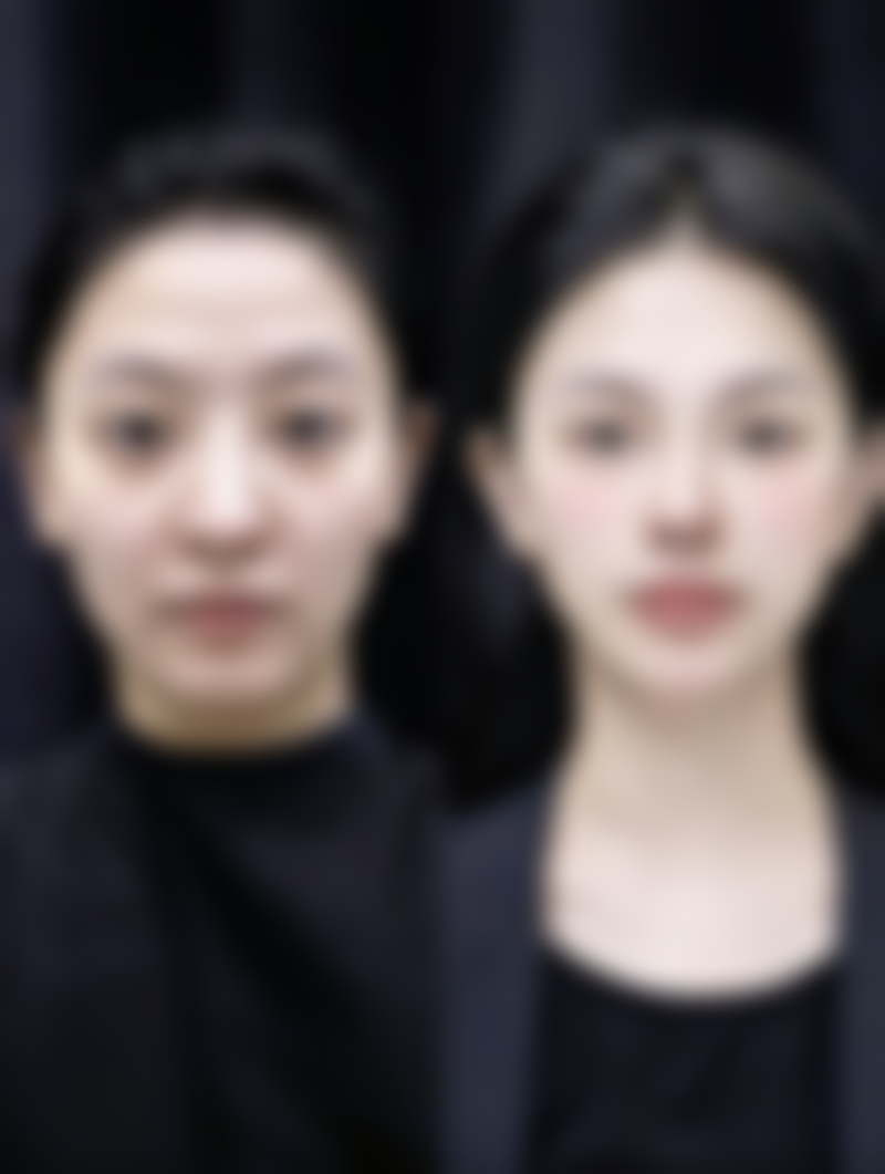 六、郑州疤痕修复医院推荐