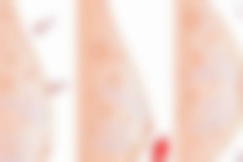 二、宜昌阿芙罗整形医院怎么样？