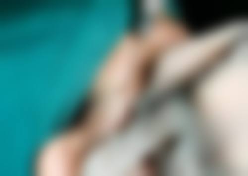 四、点阵激光能把凹陷疤痕打平吗之治疗注意事项