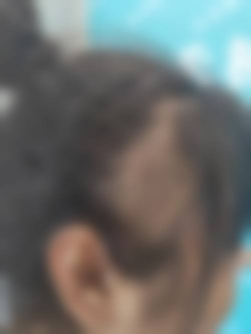 三、惠州倍生植发诊疗项目有哪些？