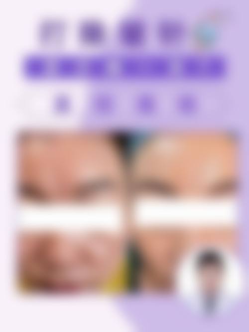 八、惠州倍生植发真实的患者评价