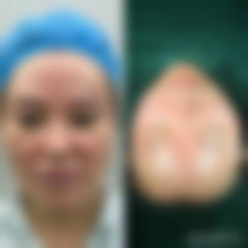 八、长沙黛颜医疗美容诊所真实的患者评价