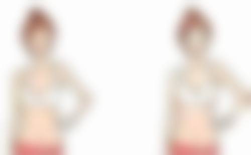 二、影响抽脂完全修复时间的因素