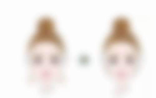 一支瘦脸针是多少单位？剂量选择关乎效果与安全，这些要点你要知道！ 