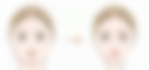 三、降低风险的措施