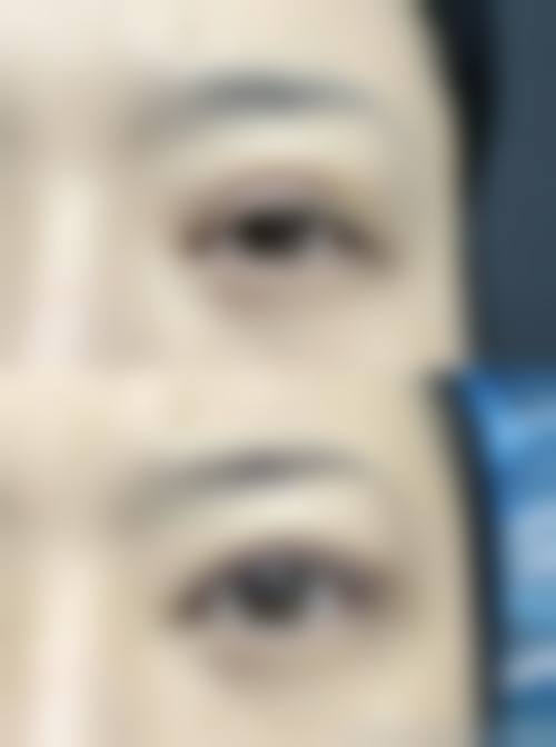 八、秦皇岛花惠医疗美容诊所真实的患者评价