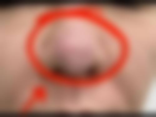 九、南京雅蒂娜医疗美容门诊真实的患者评价