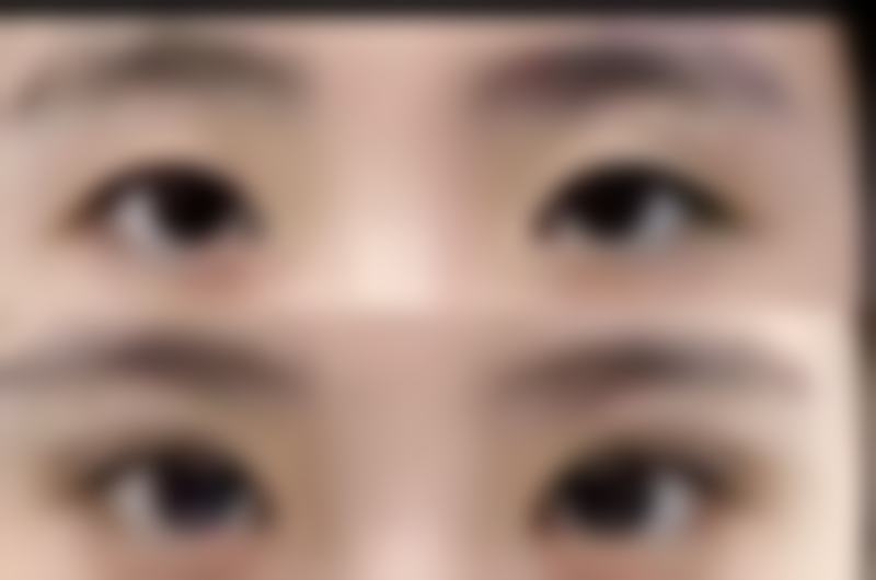 五、秦皇岛花惠医疗美容诊所价格表