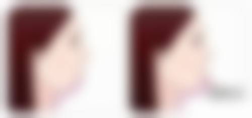 六、选择武汉斯启诺医疗美容门诊部的理由