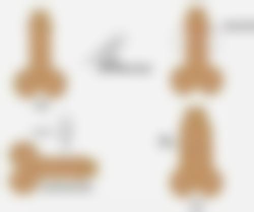 二、二十年的烫伤疤痕常见类型及改善方向