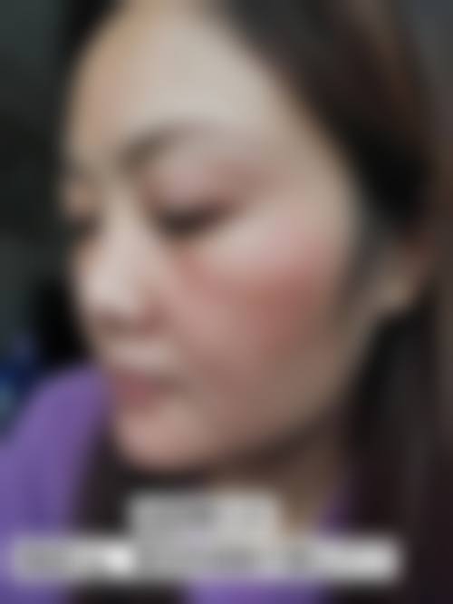 六、李明训真实的患者评价