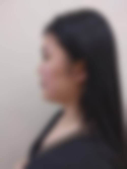 七、衡阳乔雅零叁医疗美容门诊部预约方式