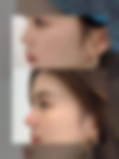 五、衡阳乔雅零叁医疗美容门诊部价格表