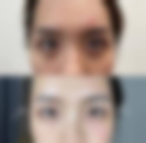 九、武安市第一人民医院(烧伤整形科)真实的患者评价