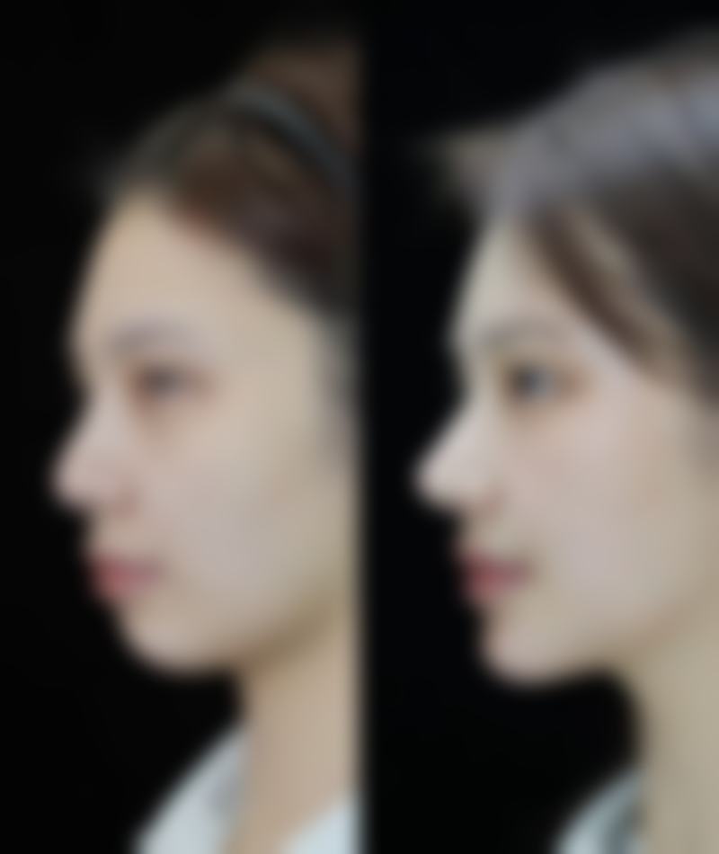 四、常冬青收费价格表