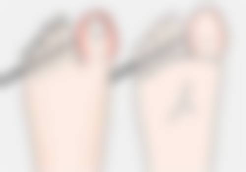 做完无痕眼袋多久能恢复正常？各阶段恢复时间及影响因素全揭秘