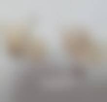 如何有效去除黑眼袋？这些小妙招助你告别熊猫眼，重焕明亮双眸！ 