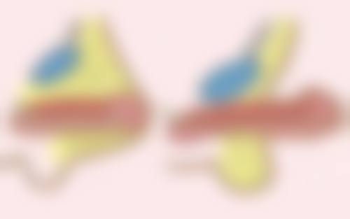 一、正常疤痕的总体概述