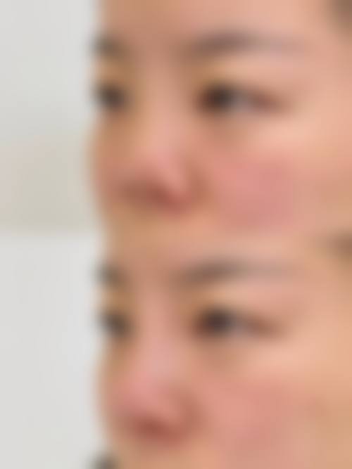 山西晋城俏丽整形怎么样？