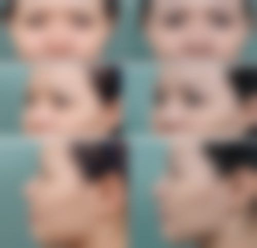 山西晋城俏丽整形诊疗项目有哪些？