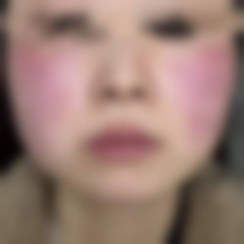 六、韩国莫德罗皮肤科地址及交通