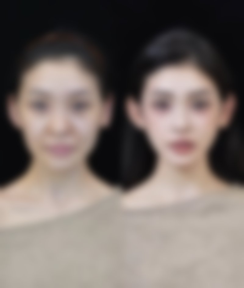 三、影响修复速度的因素