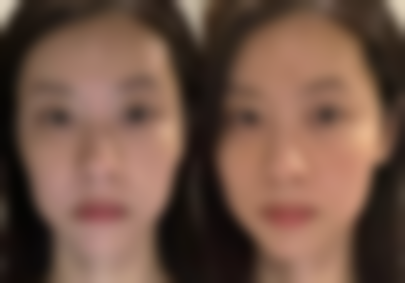 五、去除黑眼袋的注意事项