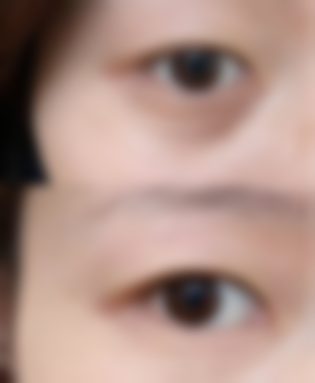 四、成都高新沐兮华颜医疗美容诊所特色项目