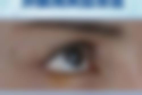 四、破腹疤痕增生的日常护理与注意事项