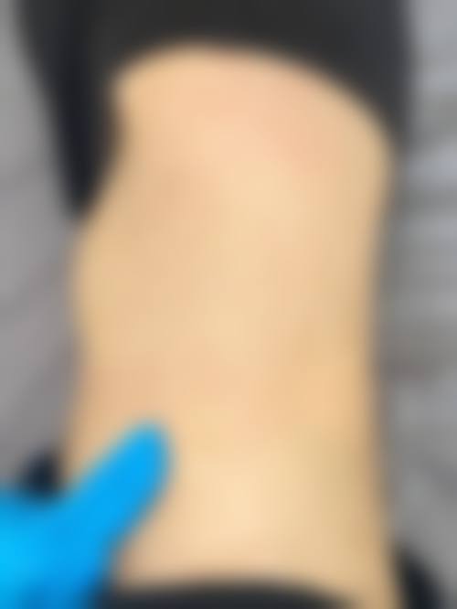 三、南宁红十字会医院医疗美容科诊疗项目有哪些？