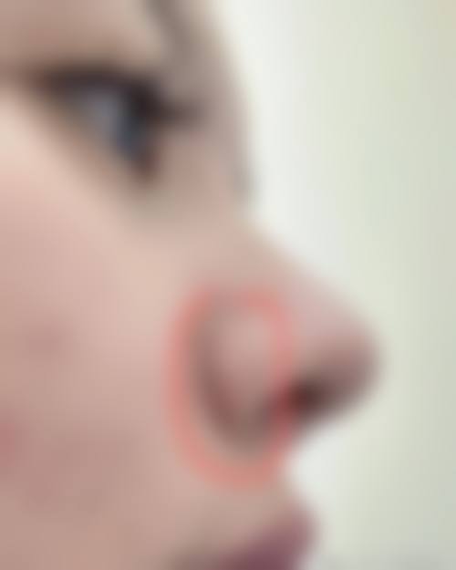 八、昆明尊尚医疗美容真实的患者评价