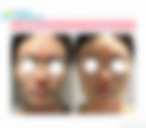 九、南宁红十字会医院医疗美容科真实的患者评价