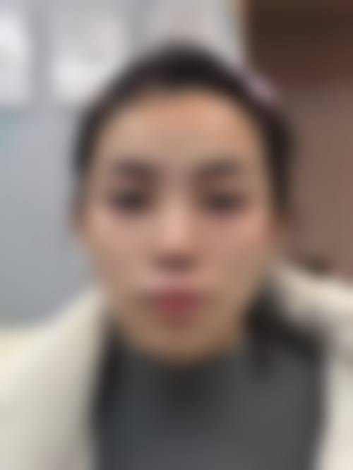 四、南宁红十字会医院医疗美容科特色项目