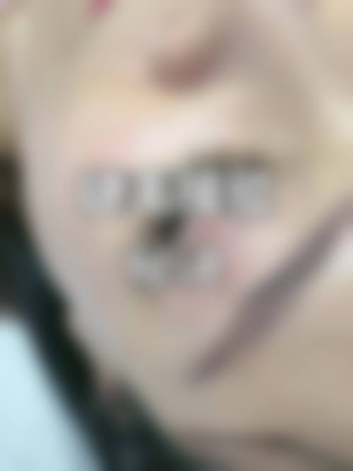 二、南宁红十字会医院医疗美容科怎么样？