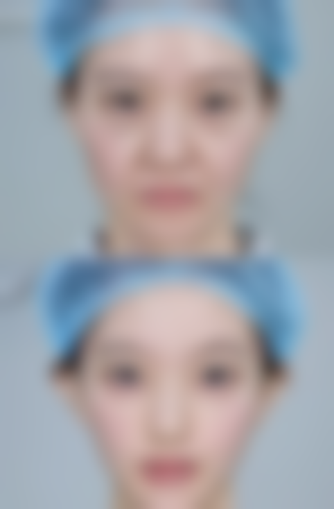 二、李明训擅长项目