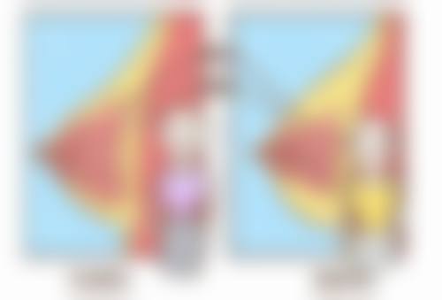 五、不同体质人群刀割留下的疤痕处理