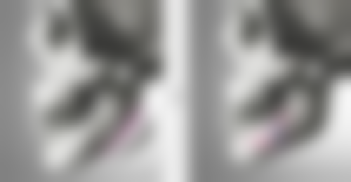 疤痕体质有什么坏处？不容忽视！