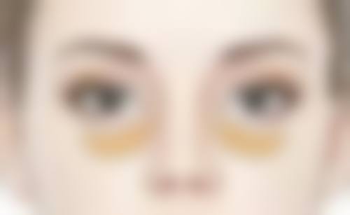 五、其他辅助改善方法