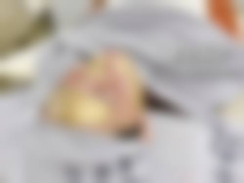 三、广西皮肤病医院诊疗项目有哪些？