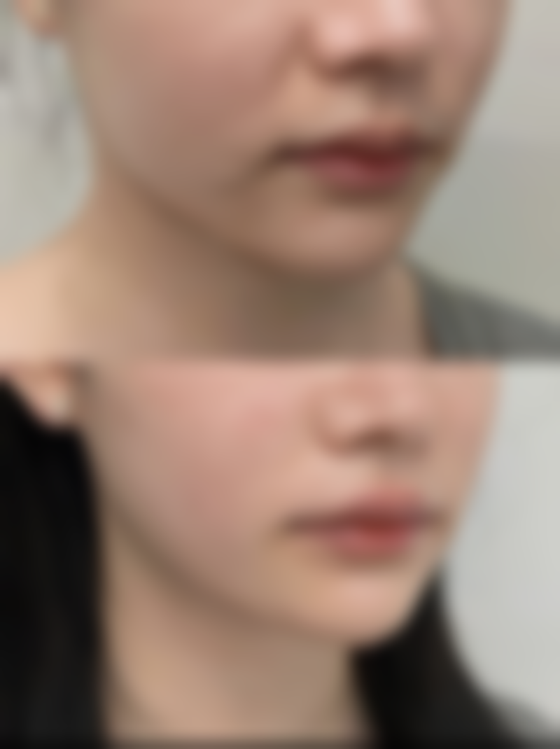 二、古山登隆擅长项目