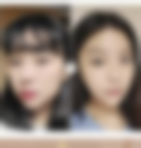 怎样消除脸上抓伤的疤痕？总结