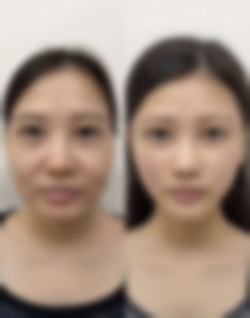 五、关于失败实例的分析