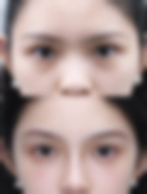 双眼皮吊顶吊多少公分合适？掌握这些要点让你的吊顶既实用又好看！ 