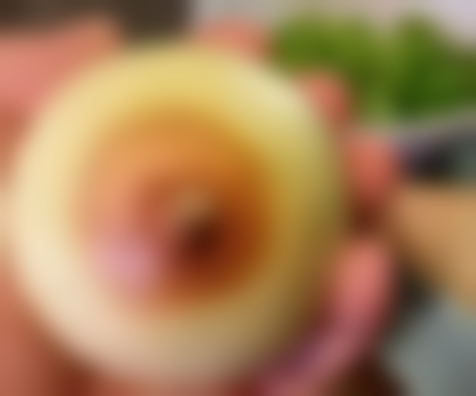 四、杭州凯丽医疗美容诊所特色项目