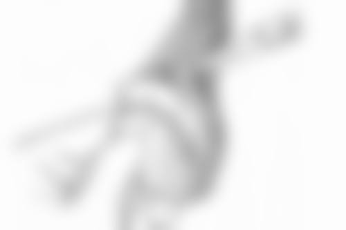 双眼皮埋线多长时间消肿？了解消肿关键因素与时间，助你快速恢复美丽双眸 