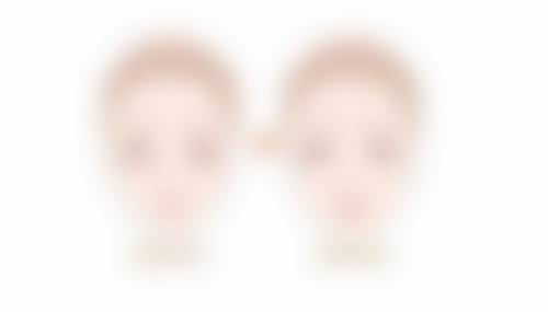 五、隆胸的其他注意事项